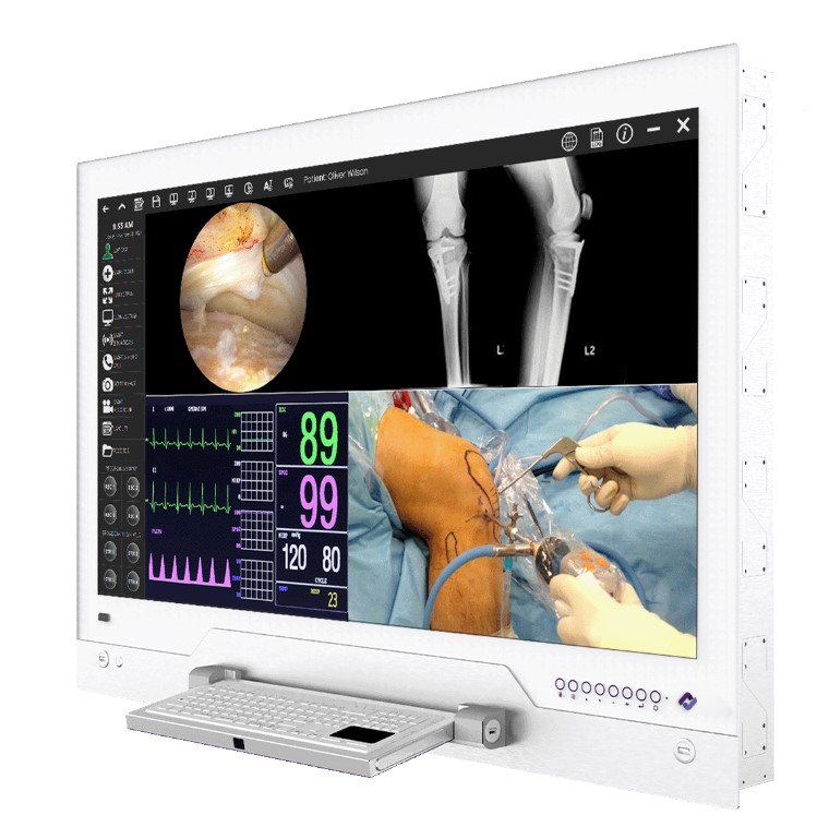 Negatoskopy cyfrowe na salę operacyjną CureLink CureLink