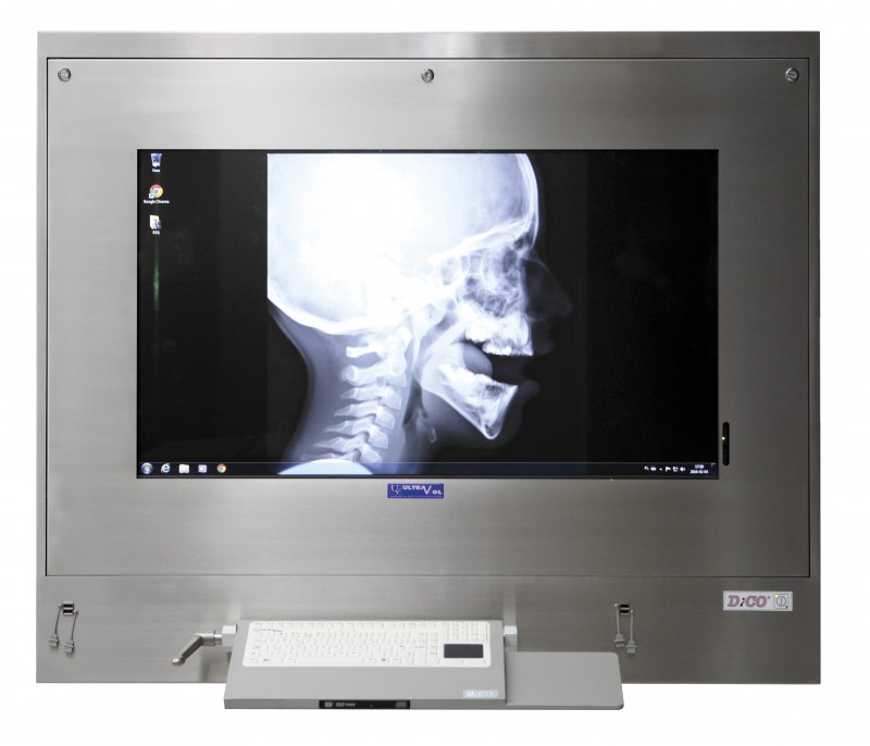Negatoskopy cyfrowe na salę operacyjną ULTRAVIOL DICO 1M 43"