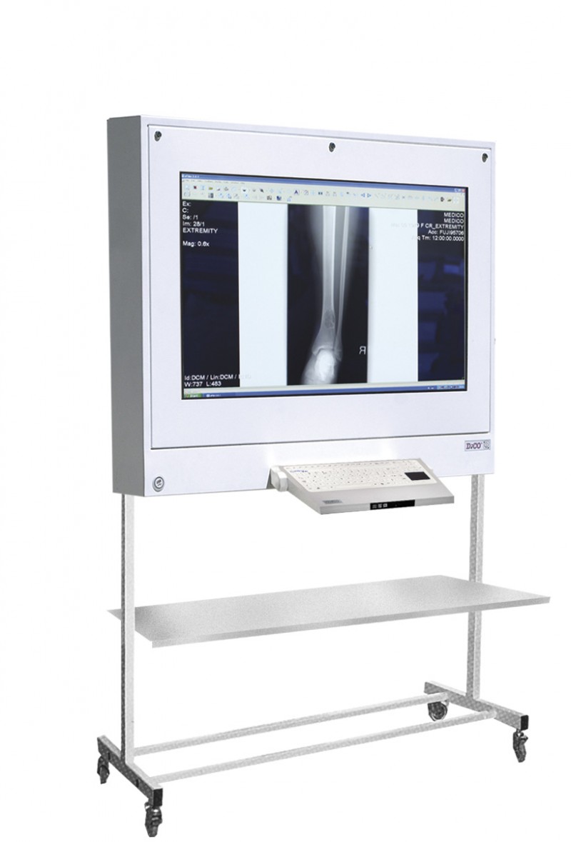 Negatoskopy cyfrowe na salę operacyjną ULTRAVIOL DICO 1M 43"