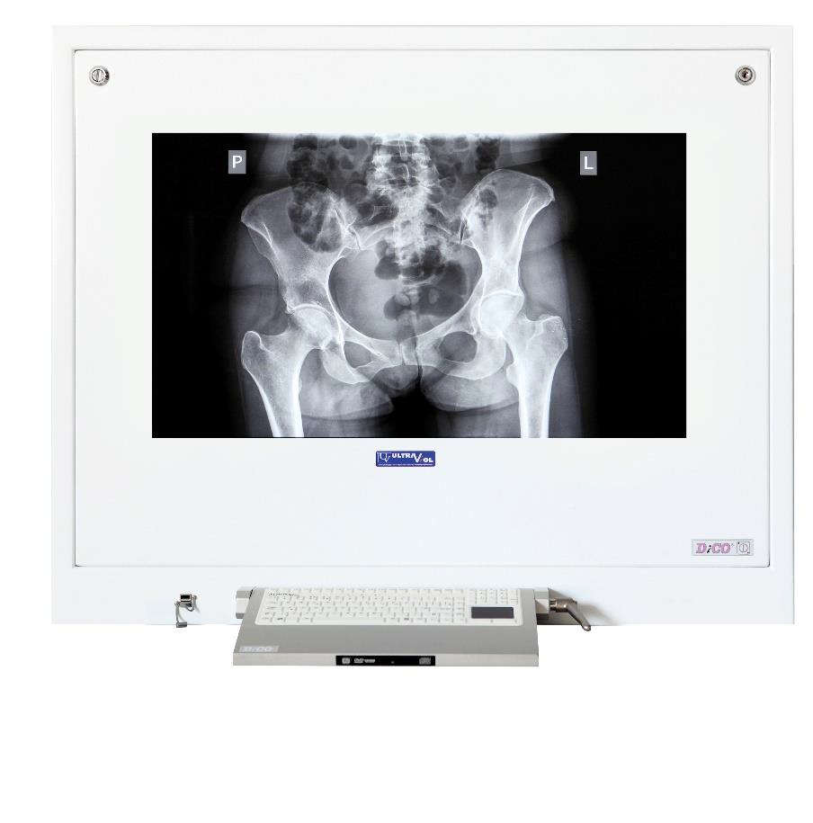 Negatoskopy cyfrowe na salę operacyjną ULTRAVIOL DICO 1M 43" -  NEGATOSKOP RZEGLĄDOWY CYFROWYCH OBRAZÓW MED.