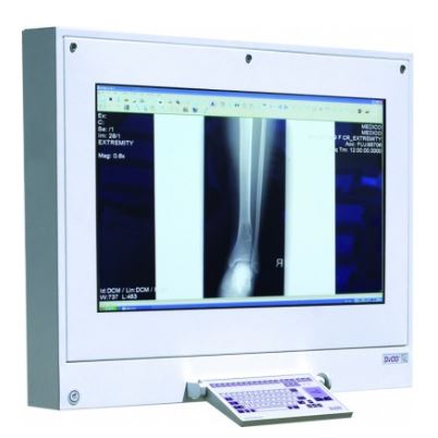 Negatoskopy cyfrowe na salę operacyjną ULTRAVIOL DICO 1M 49" NEGATOSKOP RZEGLĄDOWY CYFROWYCH OBRAZÓW MED.