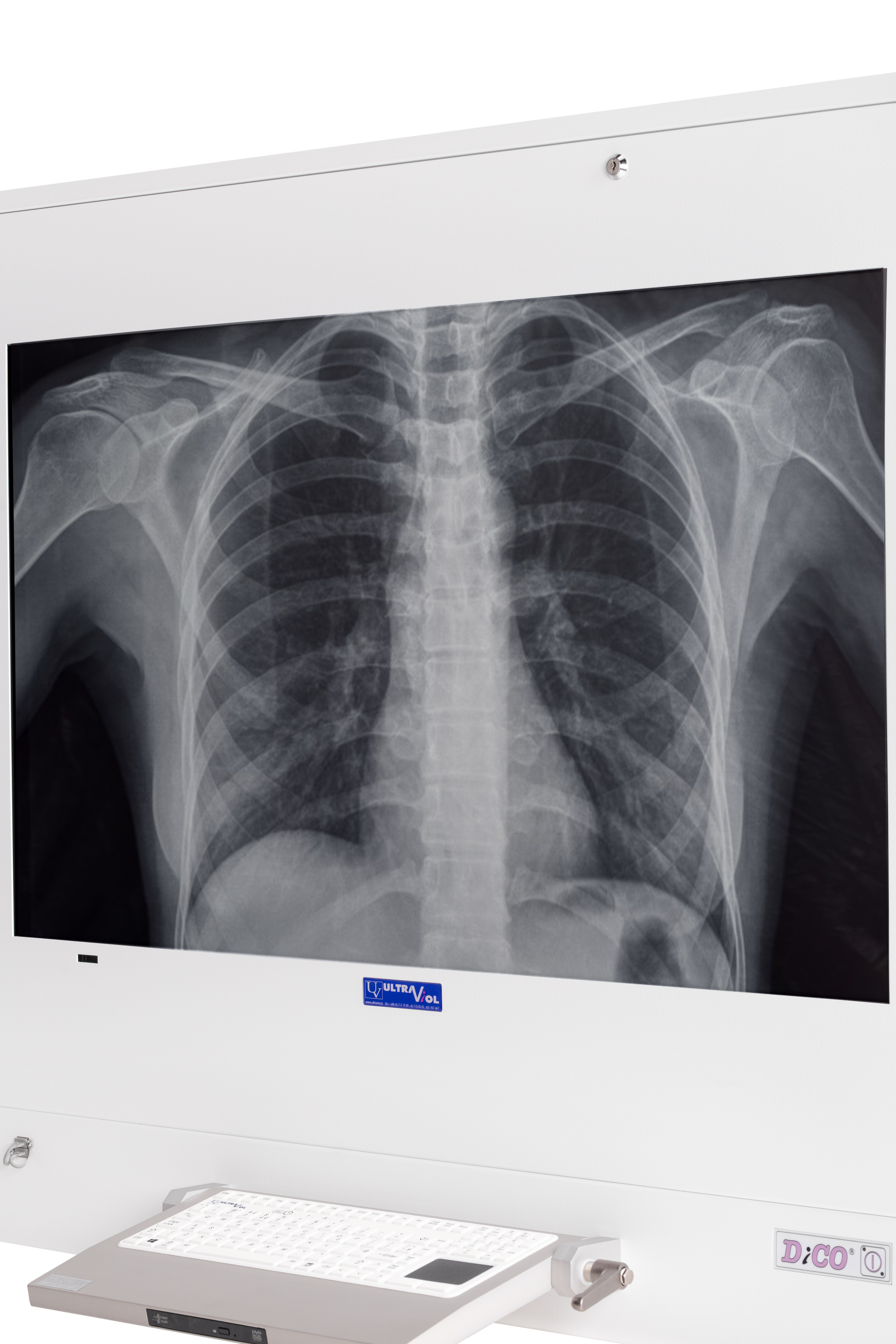 Negatoskopy cyfrowe na salę operacyjną ULTRAVIOL DICO 1M 49" NEGATOSKOP RZEGLĄDOWY CYFROWYCH OBRAZÓW MED.
