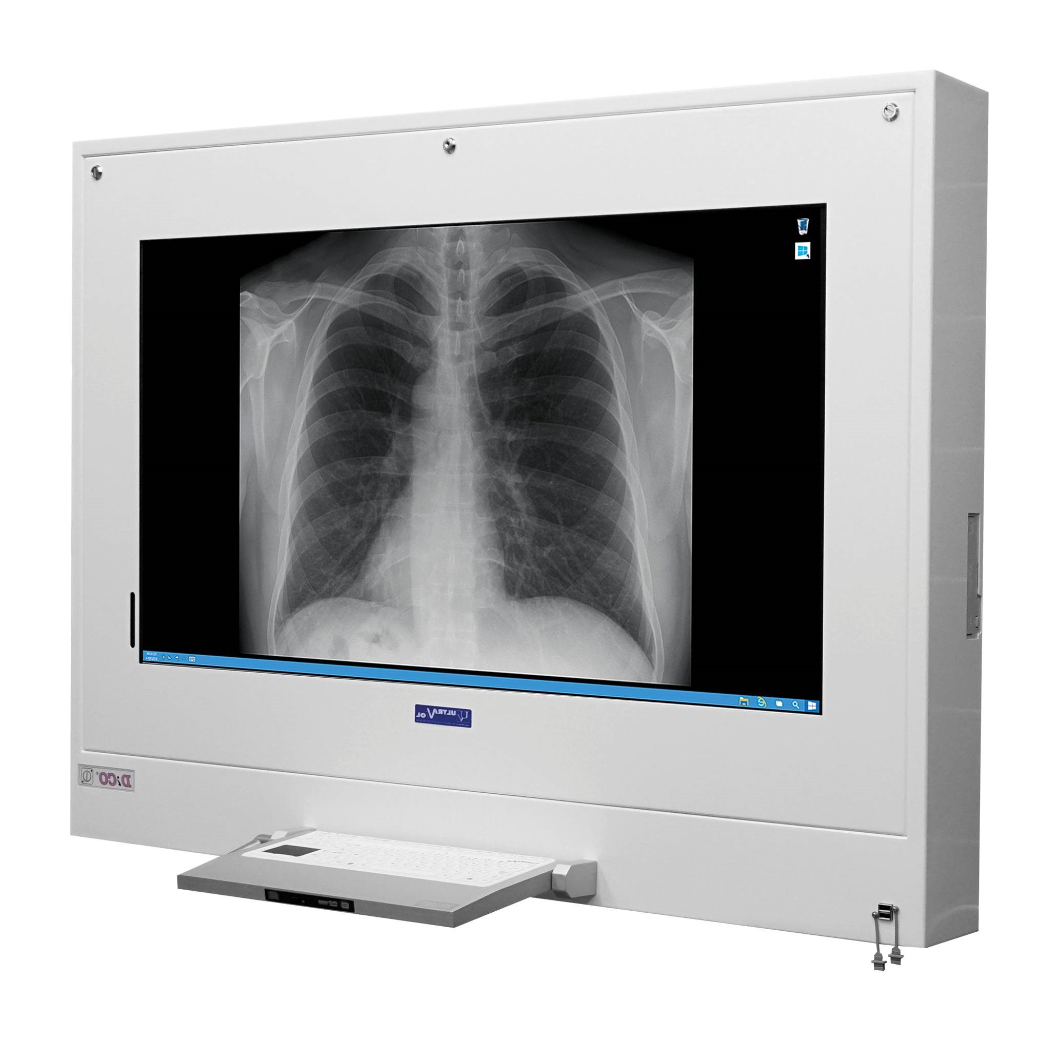 Negatoskopy cyfrowe na salę operacyjną ULTRAVIOL Negatoskop pielęgniarski All in One Dico 24"
