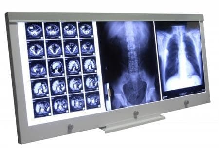 Negatoskopy SLIM LED ULTRAVIOL LED NGP 11/LED NGP 21/LED NGP 31/LED NGP 41