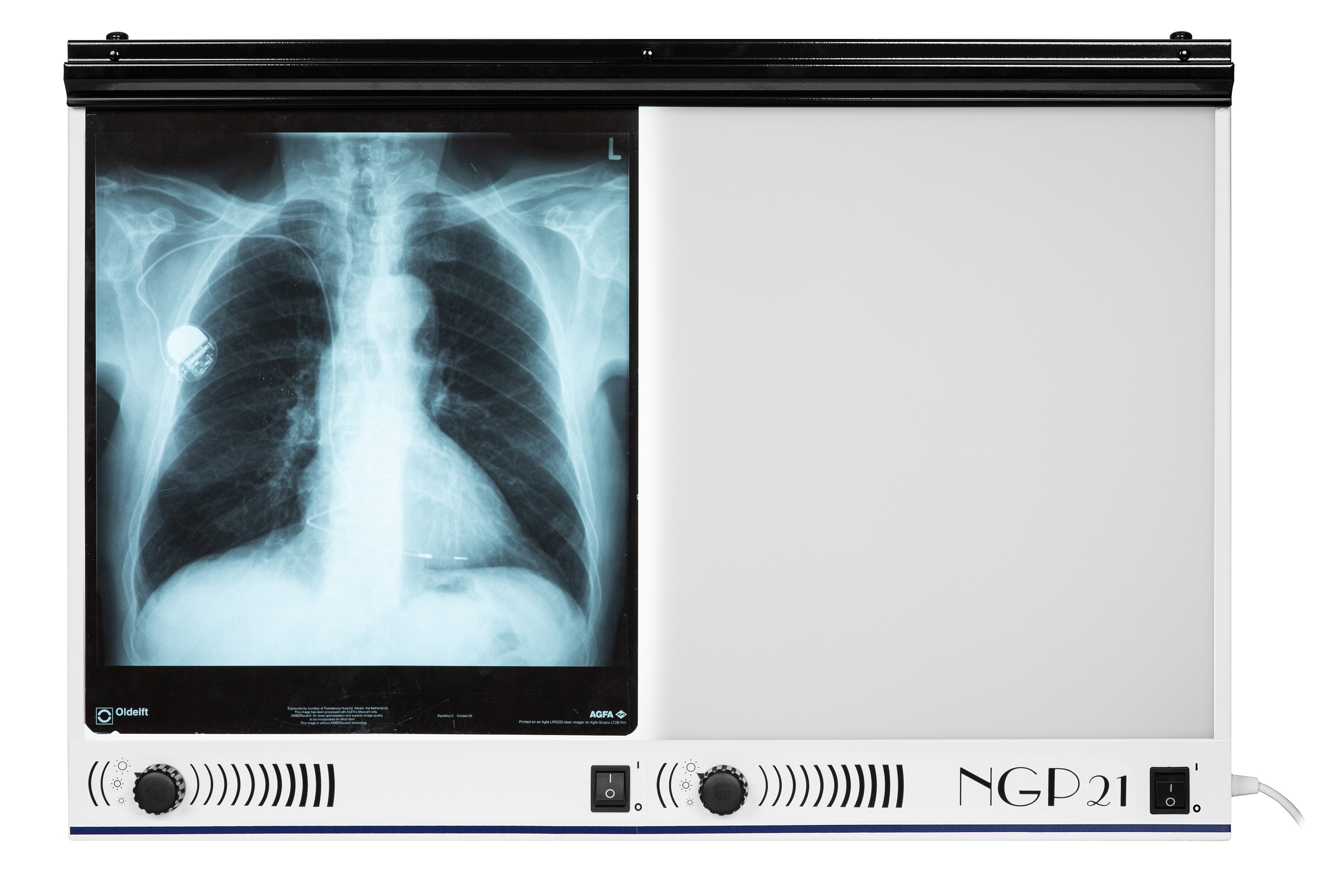 Negatoskopy z podziałem na klatki ULTRAVIOL NGP20HF - negatoskop dwuklatkowy (NGP 20 HF)