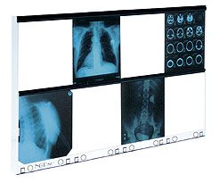 Negatoskopy z podziałem na klatki ULTRAVIOL NGP80HF - negatoskop ośmoklatkowy (NGP 80 HF)