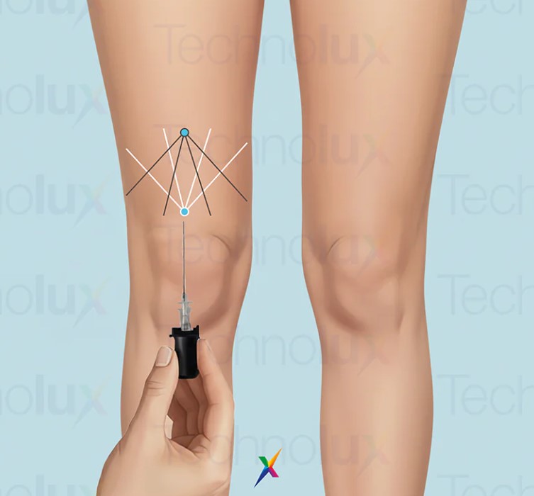 Noże plazmowe Technolux THERMA D.A.S.