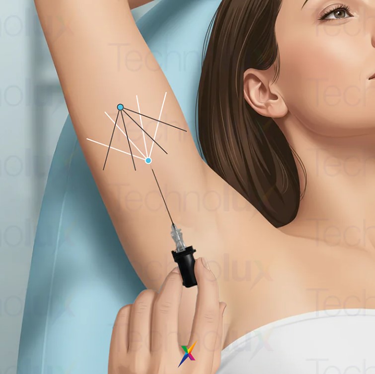 Noże plazmowe Technolux THERMA D.A.S.