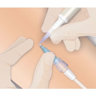 Opatrunki - kleje do mocowania cewników, drenów, kaniuli Adhezion BIOMEDICAL SecurePortIV