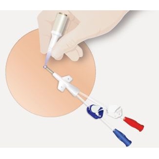 Opatrunki - kleje do mocowania cewników, drenów, kaniuli Adhezion BIOMEDICAL SecurePortIV