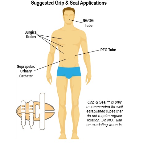 Opatrunki mocujące (cewnik, dren, kaniula) Bioderm Grip &Seal