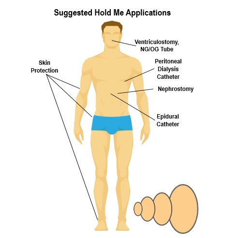 Opatrunki mocujące (cewnik, dren, kaniula) Bioderm HoldMe