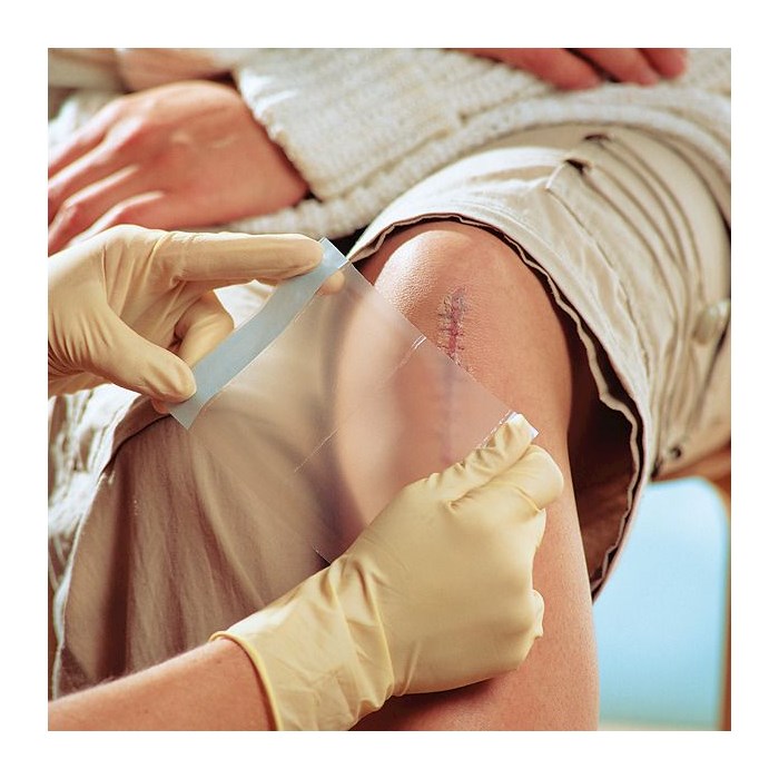 Opatrunki poliuretanowe (foliowe) HARTMANN Visulin