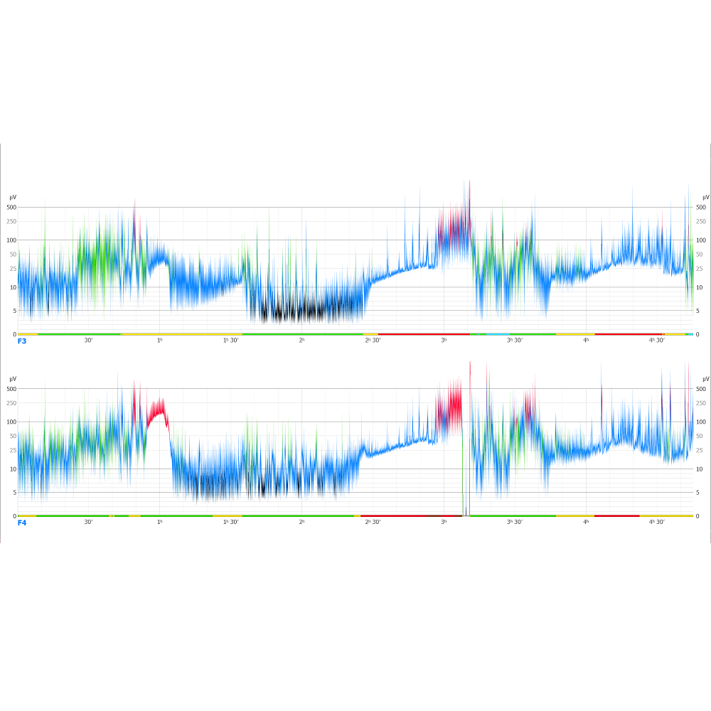 Oprogramowanie do analizy EEG ELMIKO do analizy EEG