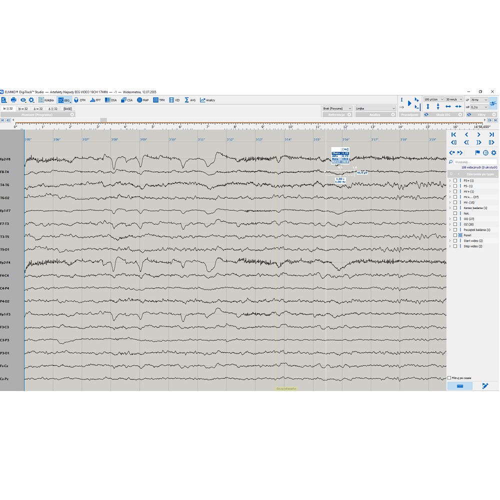 Oprogramowanie do analizy EEG ELMIKO do analizy EEG