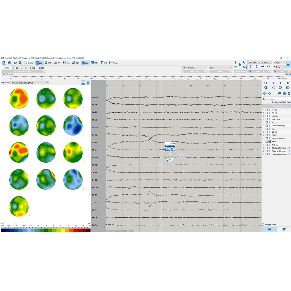 Oprogramowanie do analizy EEG ELMIKO do analizy EEG