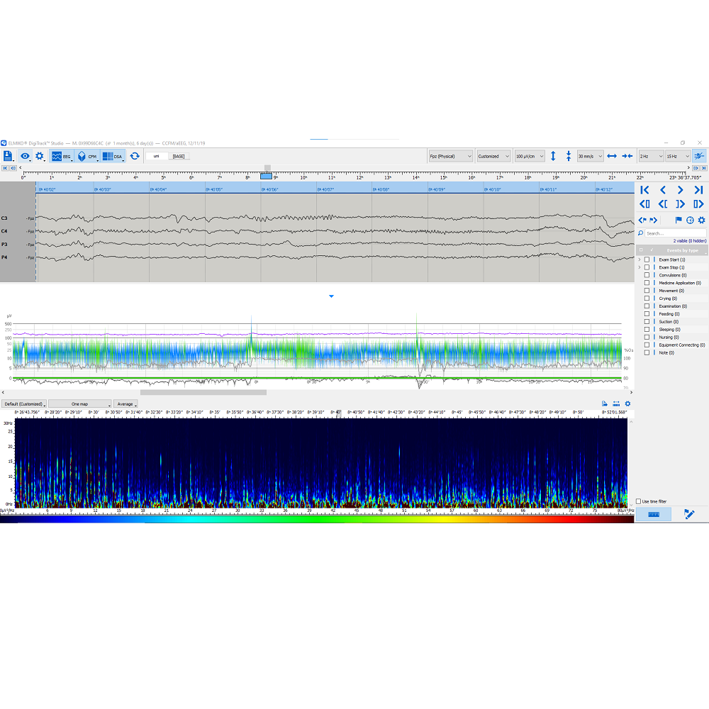Oprogramowanie do analizy EEG ELMIKO do analizy EEG