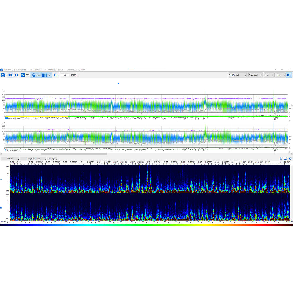 Oprogramowanie do analizy EEG ELMIKO do analizy EEG