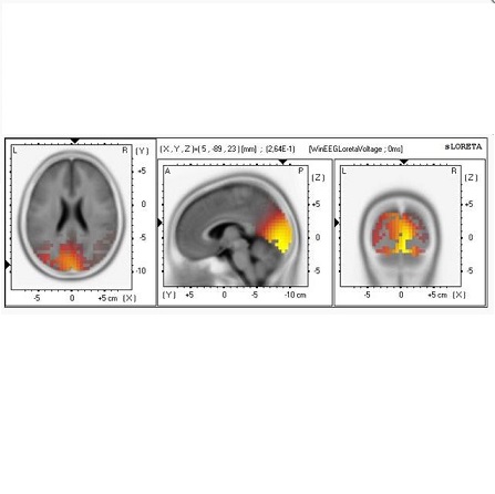 Oprogramowanie do analizy EEG Mitsar WinEEG