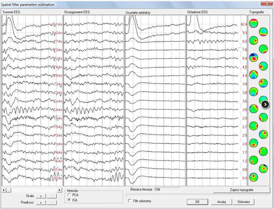 Oprogramowanie do analizy EEG Mitsar WinEEG