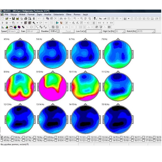 Oprogramowanie do analizy EEG Mitsar WinEEG