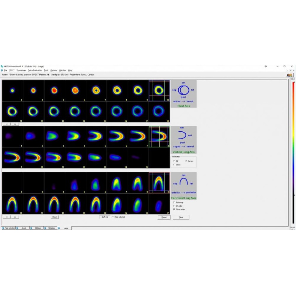 Oprogramowanie do diagnostyki obrazowej do medycyny nuklearnej Mediso Interview XP