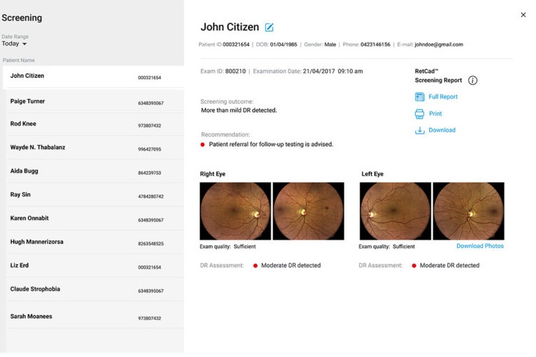 Oprogramowanie do funduskamer Icare Illume AI