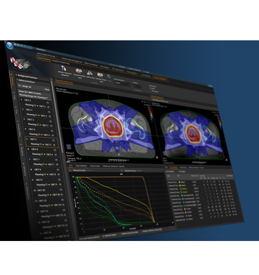 Oprogramowanie do radioterapii B/D RayStation