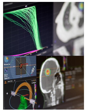 Oprogramowanie do radioterapii B/D RayStation