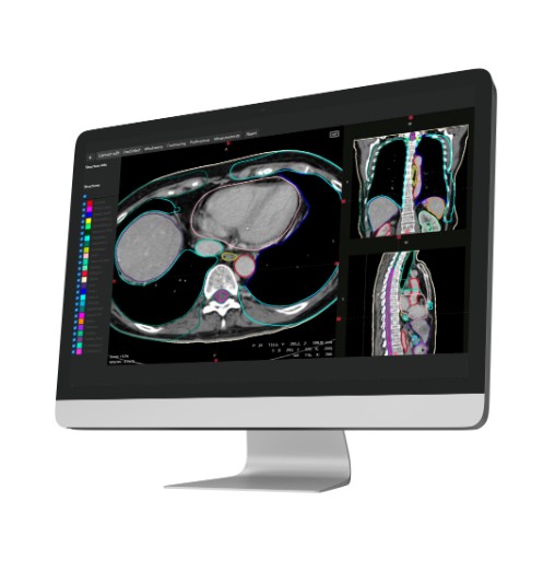Oprogramowanie do radioterapii MVision AI Contour+