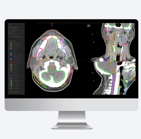 Oprogramowanie do radioterapii MVision AI Verify