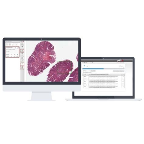 Oprogramowanie mikroskopowe PHILIPS OLT