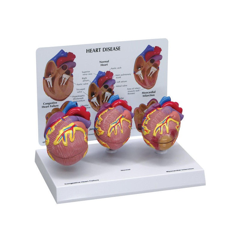 Organy i narządy 3B Scientific W33365