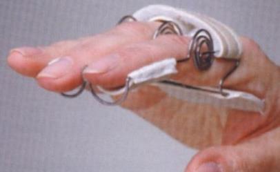 Ortezy i stabilizatory palców Antar H-DAS