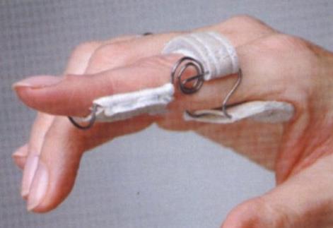 Ortezy i stabilizatory palców Antar H-SAS