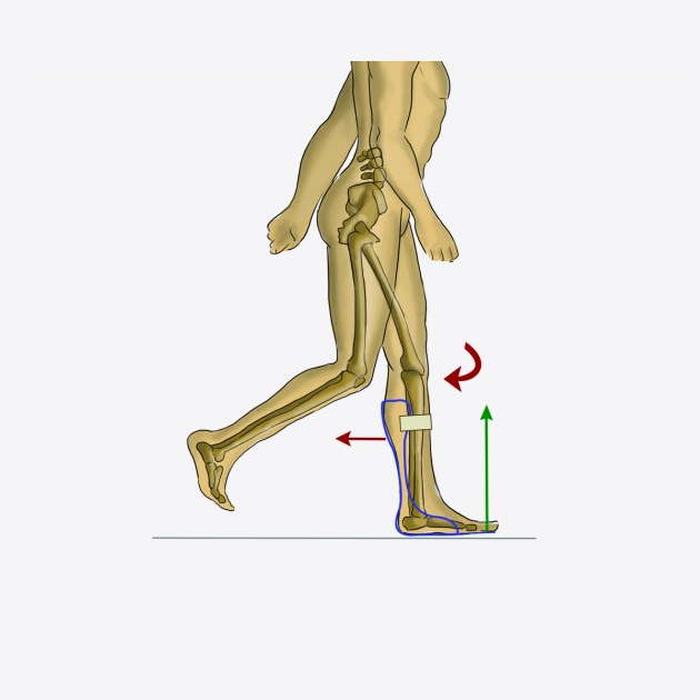 Ortezy na opadającą stopę REH4MAT AM-ASS-OS