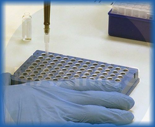 Osmometry Advanced Instruments OsmoTECH HT