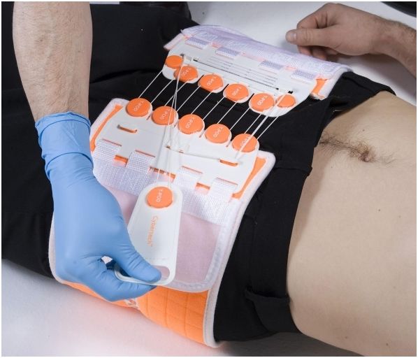 Pasy do stabilizacji złamań miednicy Arrow Int. T-POD