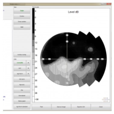 Perymetry komputerowe - polomierze FREY AP-300