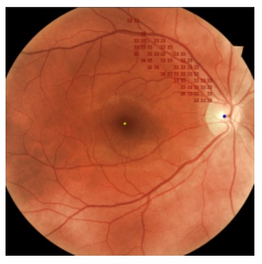 Perymetry komputerowe - polomierze FREY AP-300