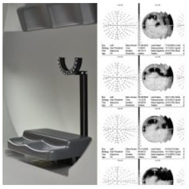 Perymetry komputerowe - polomierze FREY AP-300