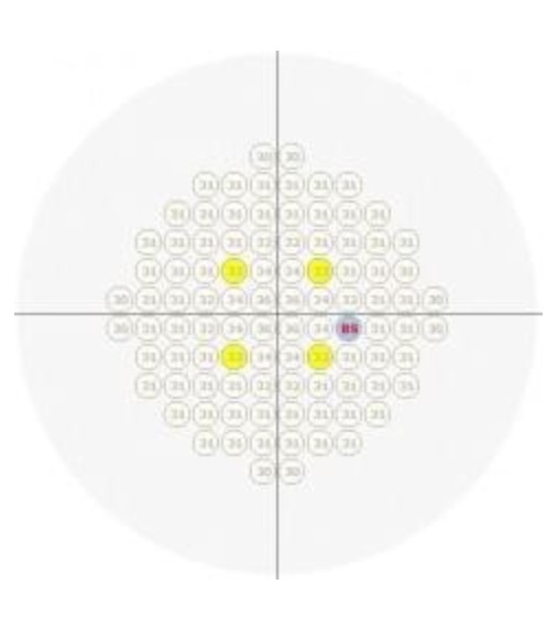 Perymetry komputerowe - polomierze FREY AP-50