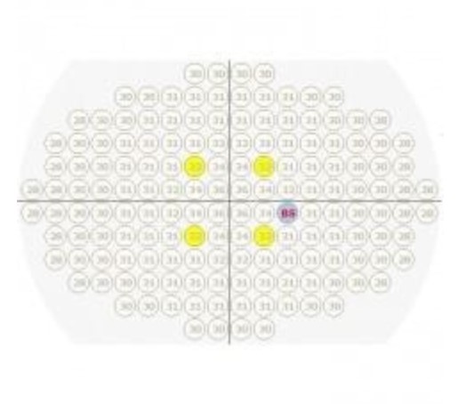 Perymetry komputerowe - polomierze FREY AP-50