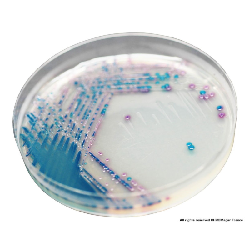 Podłoża gotowe do użycia MAST Diagnostica CHROMagar MAST201470/ MAST201402