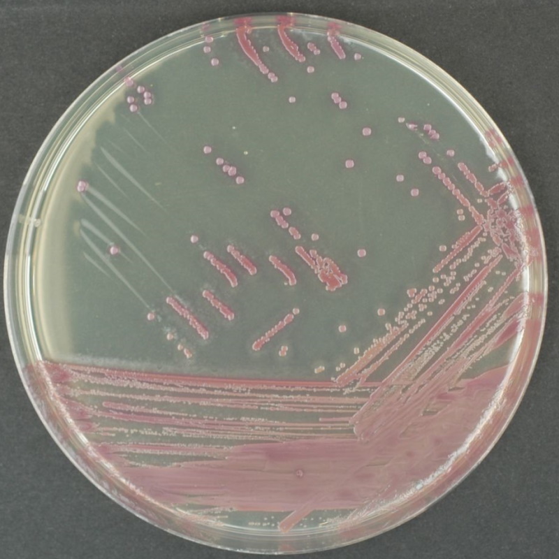 Podłoża gotowe do użycia MAST Diagnostica CHROMagar MAST201470/ MAST201402
