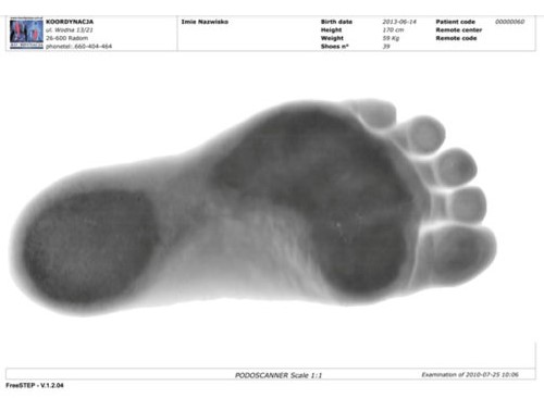 Podoskopy Koordynacja Podoscan 2D FootCAD