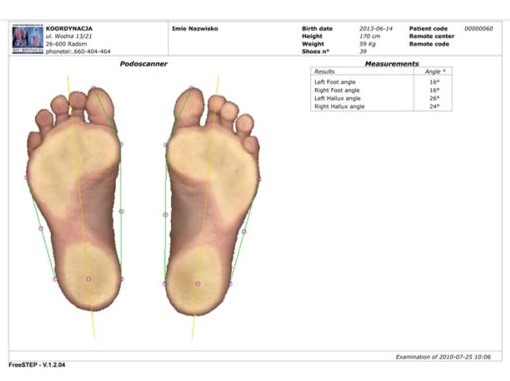 Podoskopy Koordynacja Podoscan 2D FootCAD