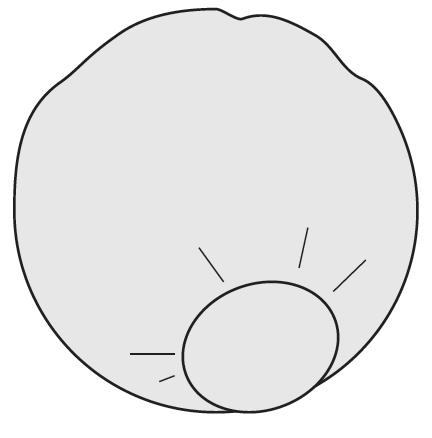 Pokrowce na urządzenia medyczne na salę operacyjną JKT/MOLNLYCKE Latus 25 380057/ Latus 50 380058/ Latus 80 380059