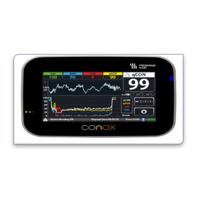 Pompy infuzyjne strzykawkowe Fresenius Kabi AGILIA SP MC TIVA