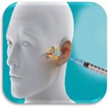 Preparaty antyzrostowe pooperacyjne BIOREGEN Biomedical PureRegen Gel Otol